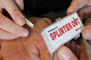 Here are some easy methods to remove a splinter at home