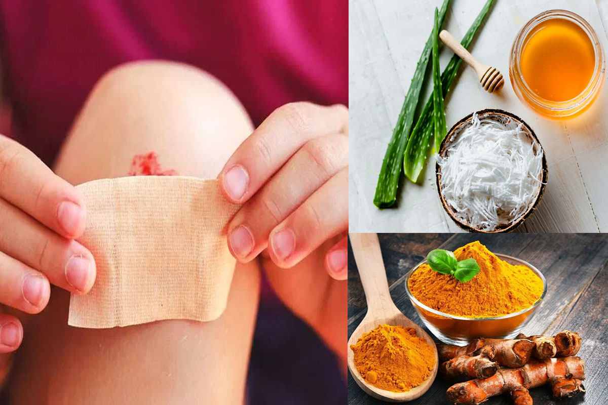 How to treat minor cuts at home with natural ingredients? - The Statesman