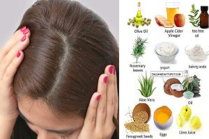 Feeling embarrassed because of dandruff! Check out these remedies