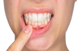 Try out these easy home remedies for gum problems