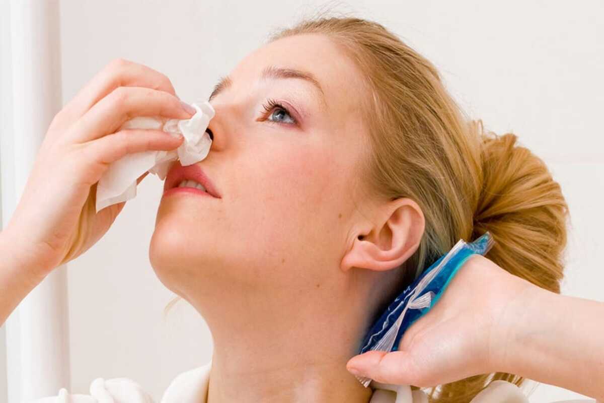 Stop your nose from bleeding with these simple ingredients