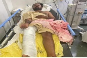 K’taka acid attacker injured in police shootout