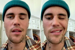 Justin Bieber Cancels all his Shows as he suffers from Ramsay Hunt syndrome
