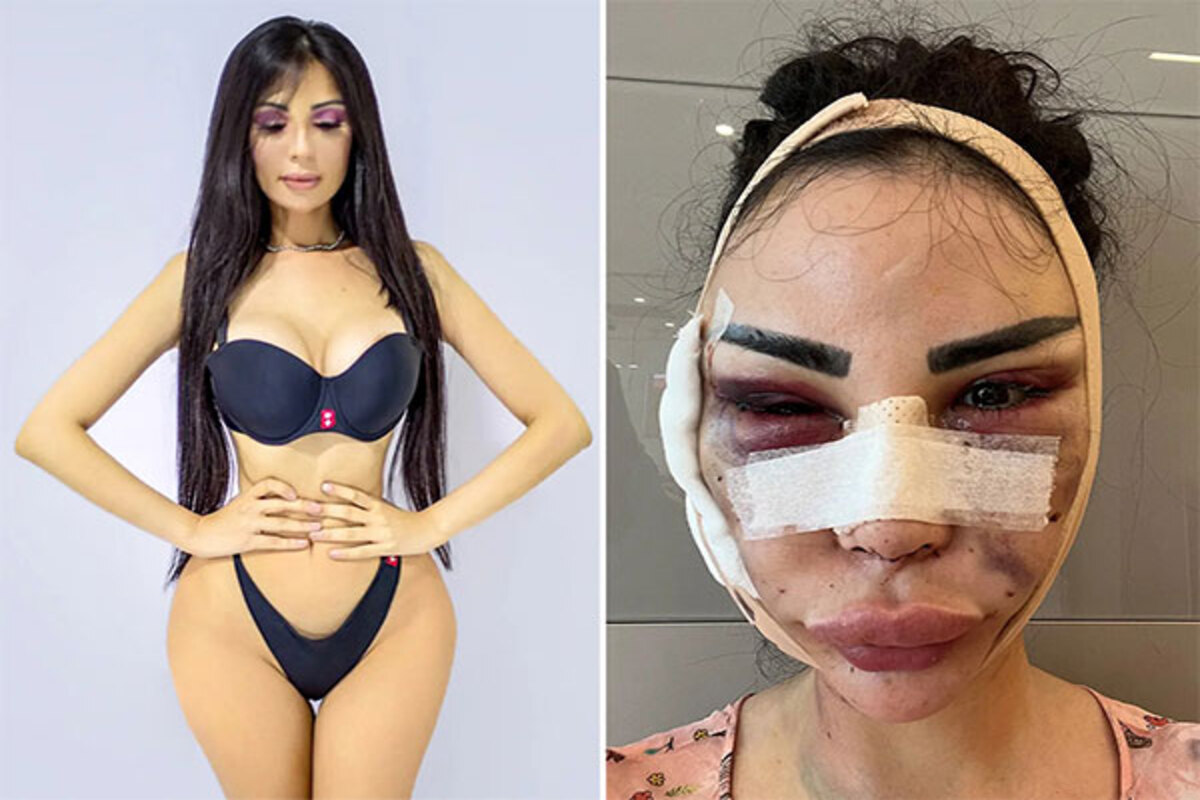 Woman spent $600K to be Kim Kardashian, now paying $120K to ‘detransition’