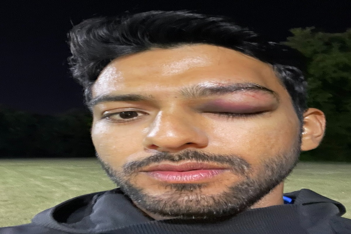 Former India U-19 star Unmukt Chand suffers serious eye injury