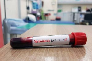 Melioidosis disease detected in Odisha