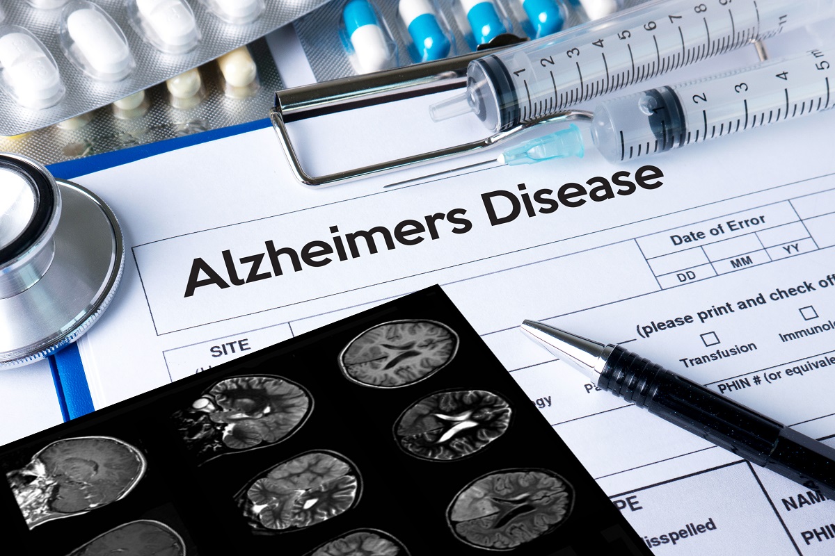 Study: Protein important in development of Alzheimer’s disease for normal learning processes