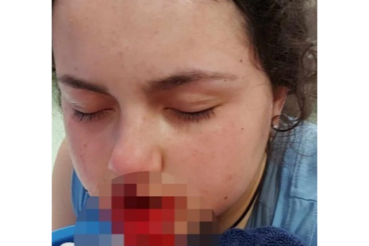 12-year-old girl horrifically mauled by pet dog in Australia