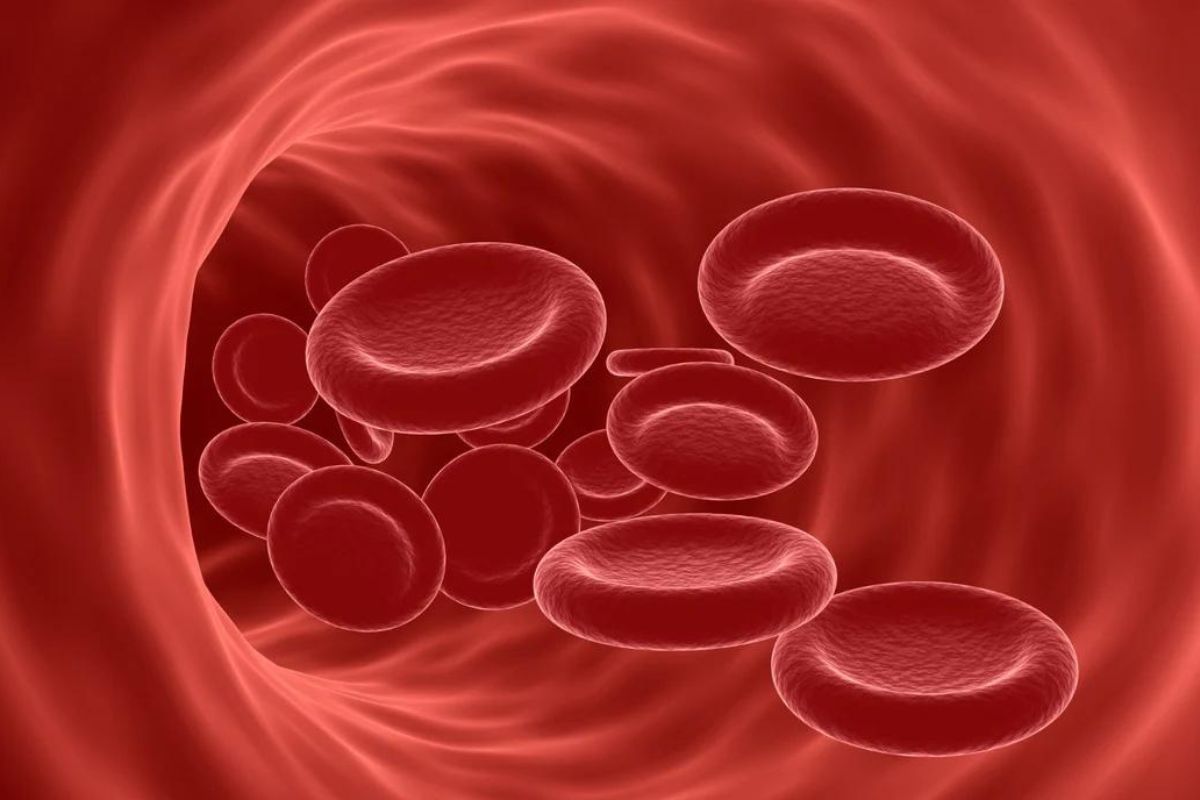 Experts call for multilateral efforts to curb prevalence of anemia