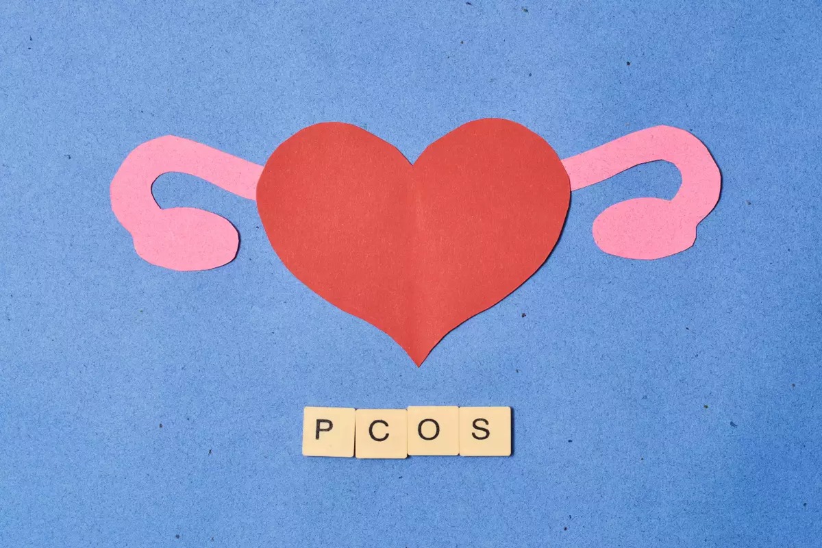 Combat PCOS Symptoms with These Foods