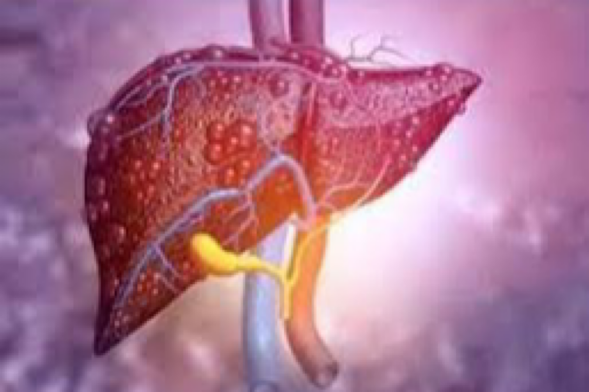 Do you know intermittent fasting protects against liver inflammation, liver cancer? Study finds