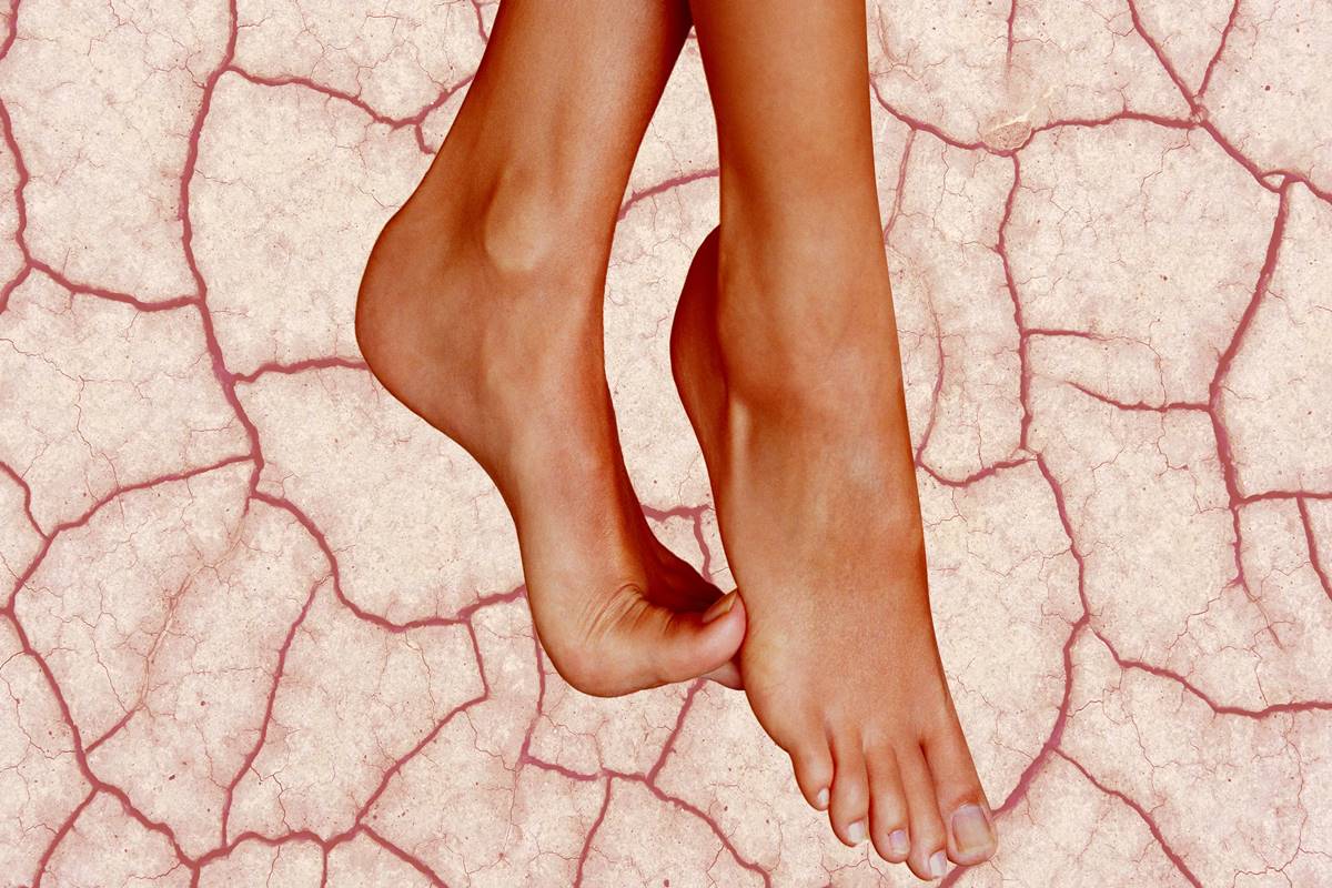Patanjali foot care: DIY Ayurvedic solutions