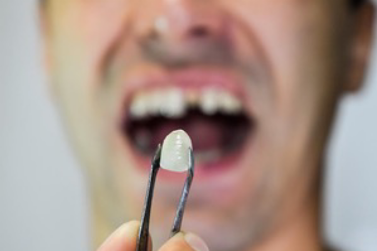 Alcohol-based mouthwash may not be good for your oral health: Study