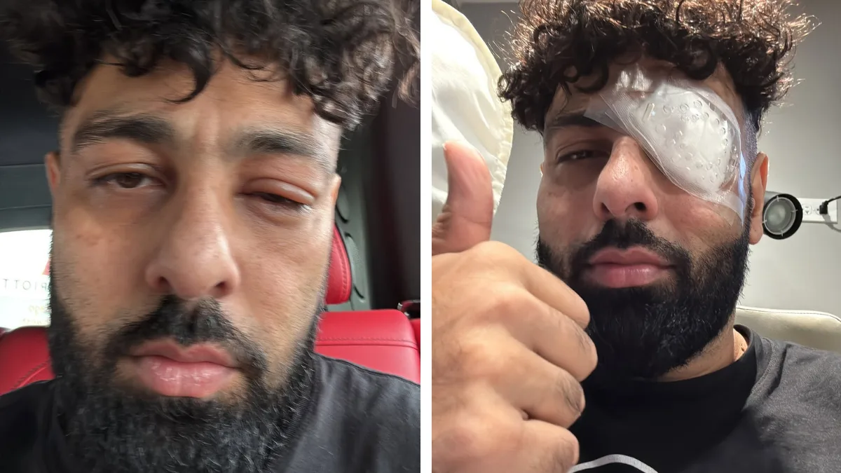 Badshah suffers eye injury but completes North America tour