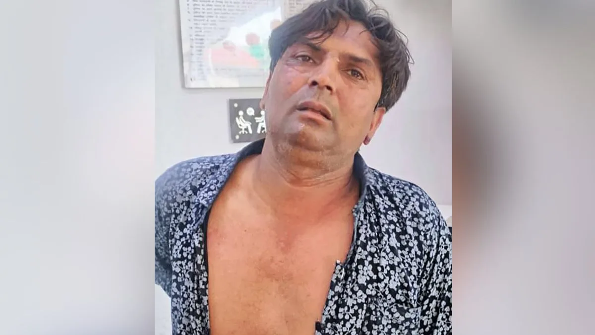 Dog lover Rajeshbhai, aide chargesheeted in attack on Delhi CM