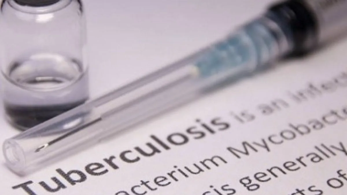 UP health dept gears up for TB-free India
