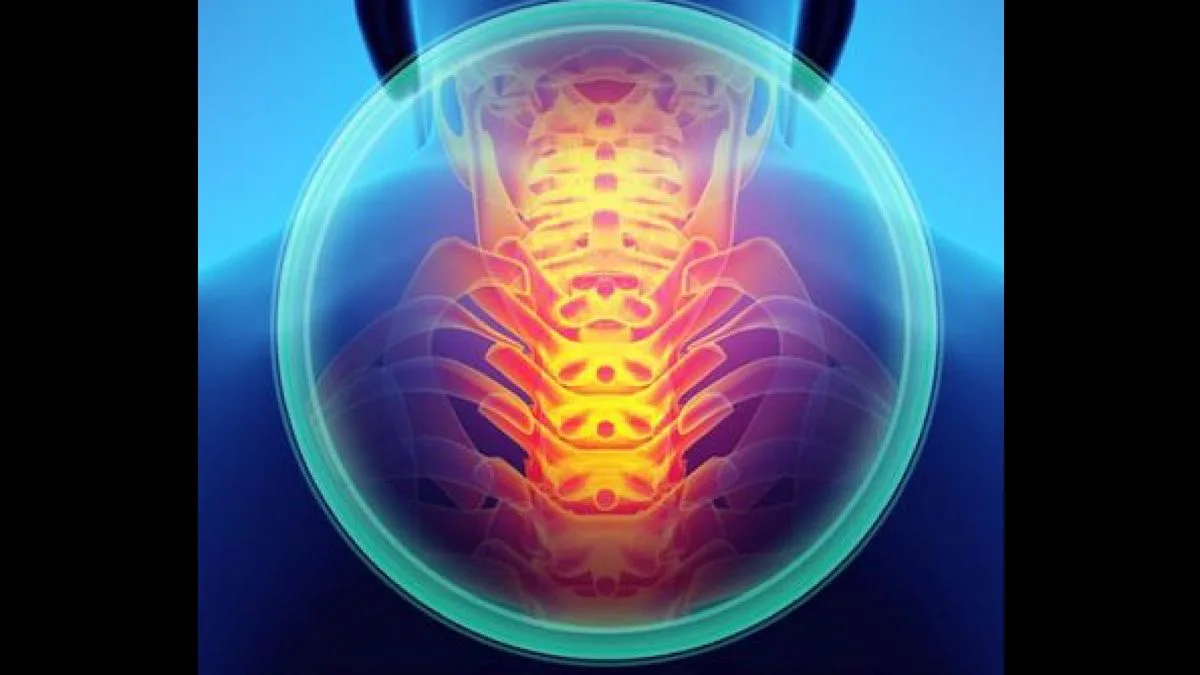Motion-preserving spine surgery offers new hope for young patients with chronic back and neck pain