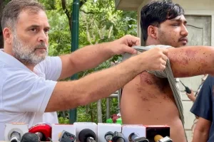 Jantar Mantar protest: Rahul Gandhi meets injured student, lifts his T-shirt to show suspected pellet gun injuries